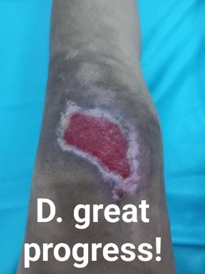 Case study motorcycle accident 4.jpg