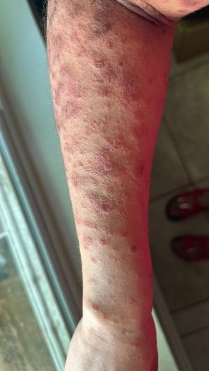 MRNA Vaccine Damage 01.jpg