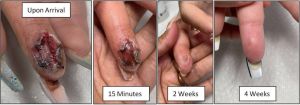 Cousin Insect Bite img 2aa7c42e049b.jpg