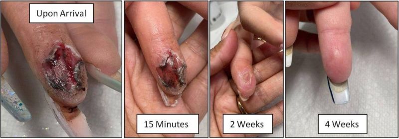 File:Cousin Insect Bite img 2aa7c42e049b.jpg