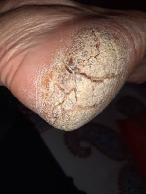 Wounds CDS Protocol D 03.jpg