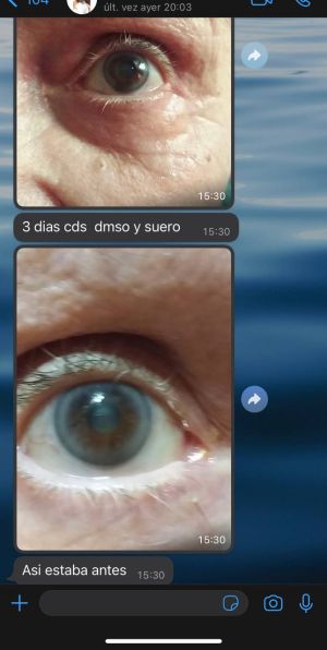 Eye CDS DMSO WhatsApp Chat.jpg