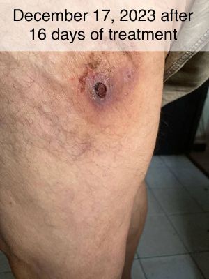 Case study hyperkeratosis pust 4.jpg
