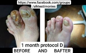 Wounds CDS Protocol D 05.jpg