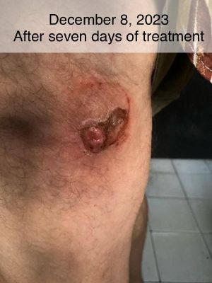 Case study hyperkeratosis pust 3.jpg