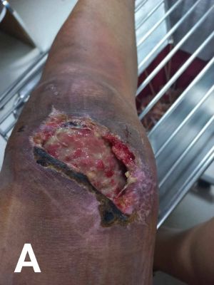 Case study motorcycle accident 1.jpg