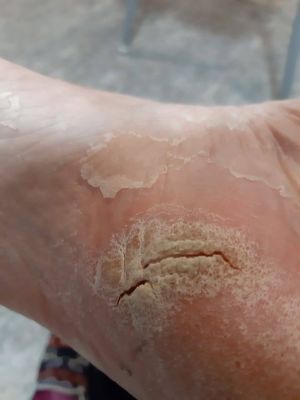 Wounds CDS Protocol D 08.jpg