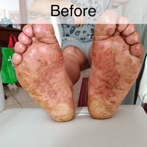 Case study 3-year abscess heal 1.jpg