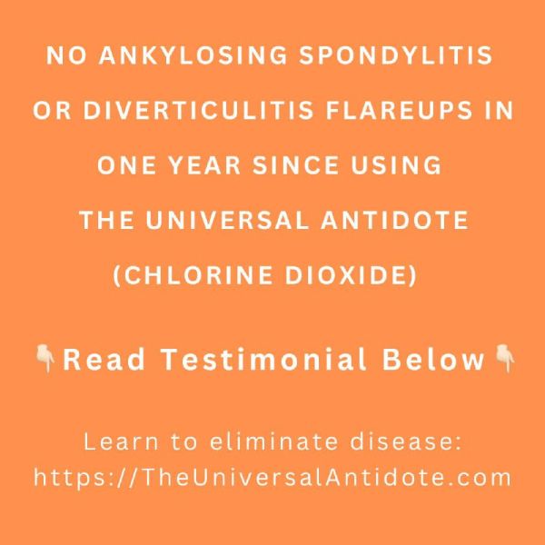 File:Ankylosing Spondylitis Result.jpg