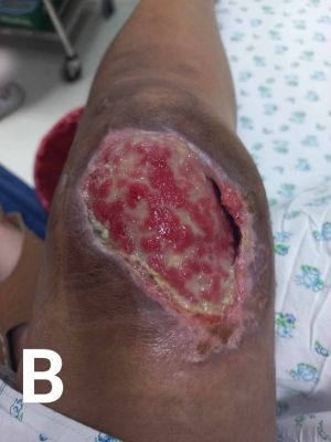 Case study motorcycle accident 2.jpg