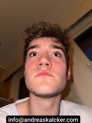 CFS CDS Lip After.jpg