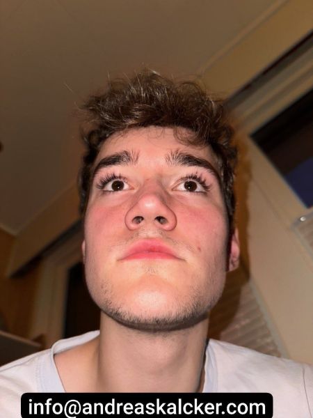File:CFS CDS Lip After.jpg
