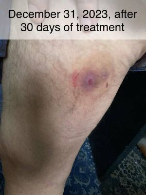 Case study hyperkeratosis pust 5.jpg