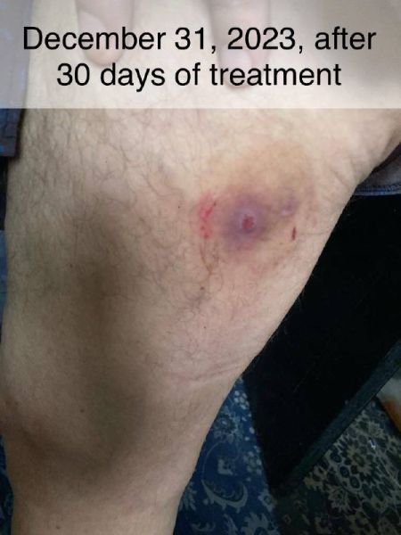 File:Case study hyperkeratosis pust 5.jpg