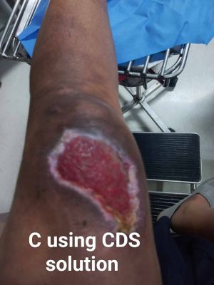 Case study motorcycle accident 3.jpg