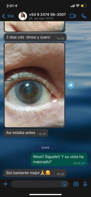 Eye CDS DMSO After.jpg