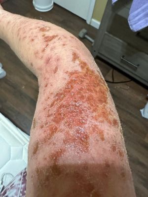 MRNA Vaccine Damage 02.jpg