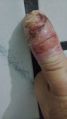 Thumbnail for version as of 21:19, 18 July 2026