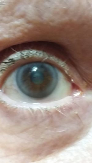Eye CDS DMSO Before.jpg