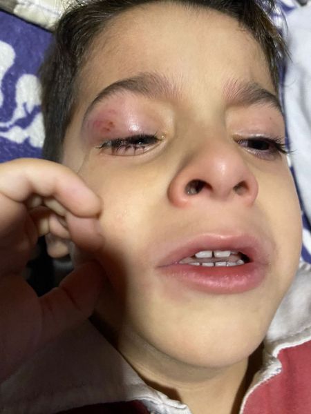 File:Case study neurodermatitis cur 1.jpg