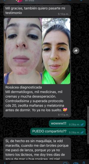 Case study rosacea controlled 1.jpg