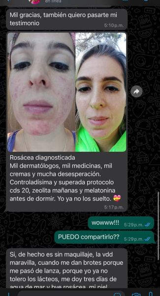File:Case study rosacea controlled 1.jpg