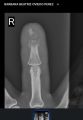 Thumbnail for version as of 21:36, 18 July 2026