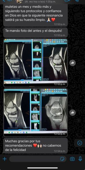 File:Osteochondritis 2.jpg
