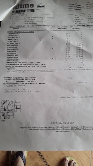 Case study congenital hiv in l 10.jpg