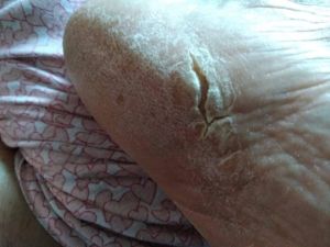 Wounds CDS Protocol D 04.jpg