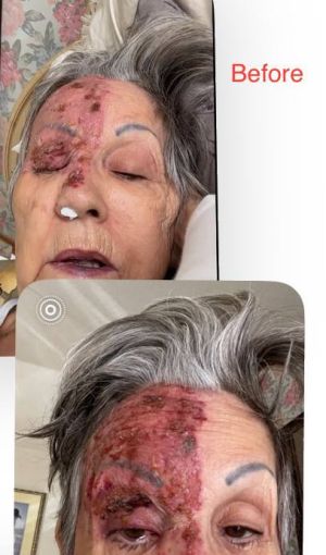 Case study severe facial shing 1.jpg