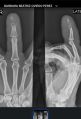 Thumbnail for version as of 21:36, 18 July 2026