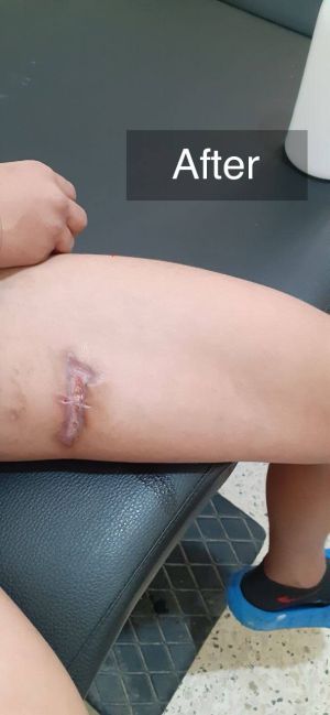 Case study severe infected dog 2.jpg
