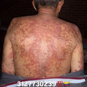 FB CDS Spray 01.jpg